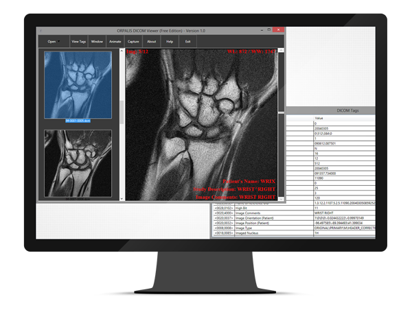 GdPicture.NET DICOM Image Reader Plugin